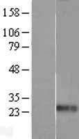 Endothelin 1 (EDN1) Human Over-expression Lysate