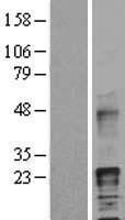 HB EGF (HBEGF) Human Over-expression Lysate