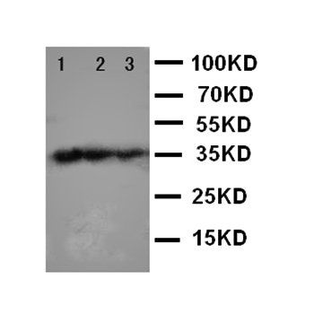 T-bet/Tbx21 Rabbit Polyclonal Antibody