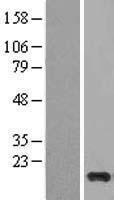 Cystatin S (CST4) Human Over-expression Lysate