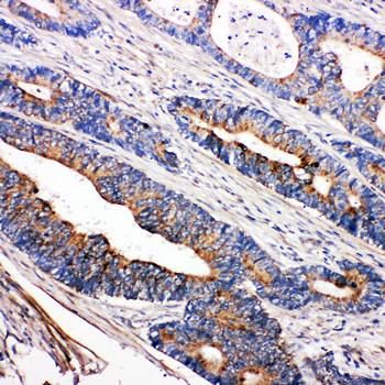 Tyrosine-protein kinase Tec Tec Rabbit Polyclonal Antibody