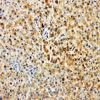 Tyrosine-protein kinase Tec Tec Rabbit Polyclonal Antibody