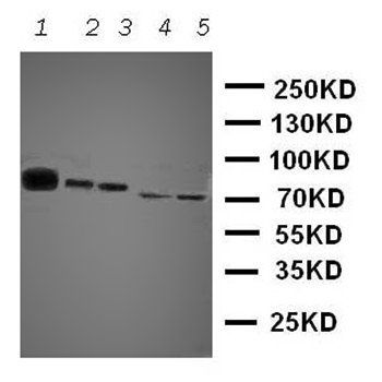 Tyrosine-protein kinase Tec Tec Rabbit Polyclonal Antibody