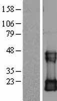 CDC42 Human Over-expression Lysate