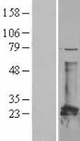 CBFB Human Over-expression Lysate