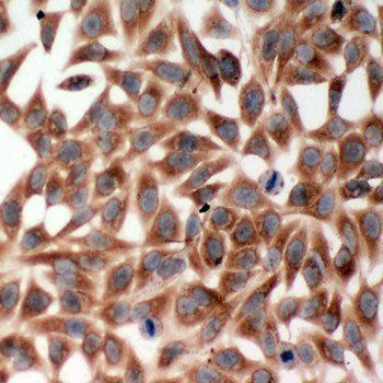 TRAF2 Rabbit Polyclonal Antibody