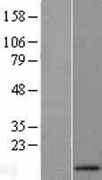 Apolipoprotein A II (APOA2) Human Over-expression Lysate