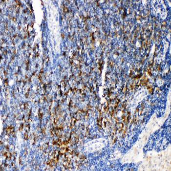 TRAF4 Rabbit Polyclonal Antibody