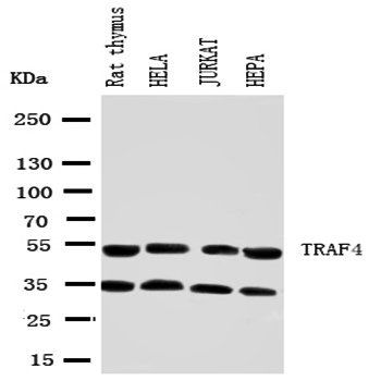 TRAF4 Rabbit Polyclonal Antibody