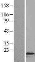 FLAP (ALOX5AP) Human Over-expression Lysate