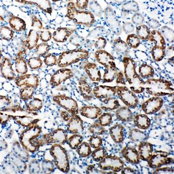 TRAM1 Rabbit Polyclonal Antibody