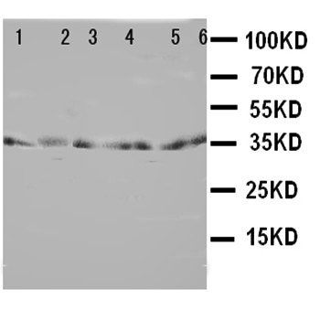 TRAM1 Rabbit Polyclonal Antibody