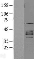 CXCR2 Human Over-expression Lysate
