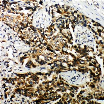 Hamartin/TSC1 Rabbit Polyclonal Antibody