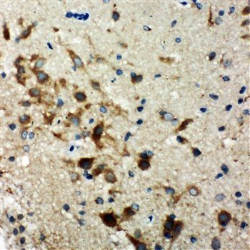 Hamartin/TSC1 Rabbit Polyclonal Antibody