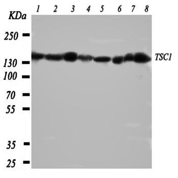 Hamartin/TSC1 Rabbit Polyclonal Antibody
