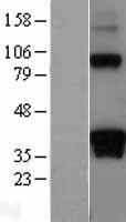 DAZL Human Over-expression Lysate