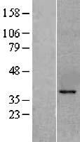KLF6 Human Over-expression Lysate