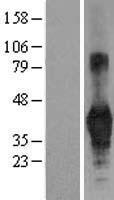 CD40 Human Over-expression Lysate