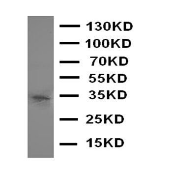 Aquaporin 10/AQP10 Rabbit Polyclonal Antibody