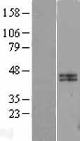 Calumenin (CALU) Human Over-expression Lysate
