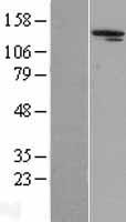 Aldehyde Oxidase (AOX1) Human Over-expression Lysate