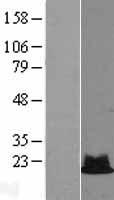 RPS19 Human Over-expression Lysate