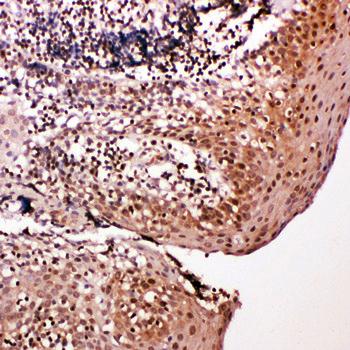 Caspase-14/CASP14/14 Rabbit Polyclonal Antibody
