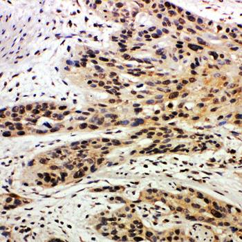 Caspase-14/CASP14/14 Rabbit Polyclonal Antibody