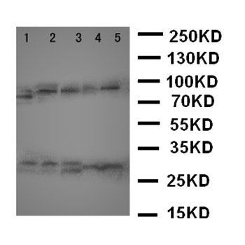 Caspase-14/CASP14/14 Rabbit Polyclonal Antibody