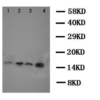 Stefin B/CSTB Rabbit Polyclonal Antibody