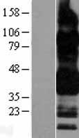 CD32B (FCGR2B) Human Over-expression Lysate