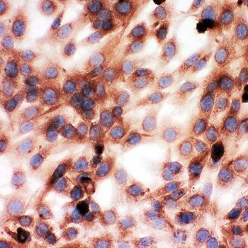Gelsolin/GSN Rabbit Polyclonal Antibody