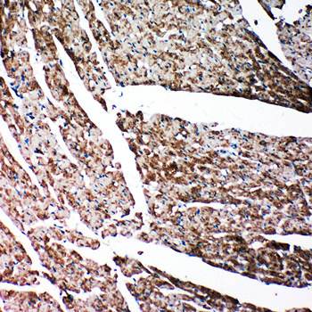 Gelsolin/GSN Rabbit Polyclonal Antibody