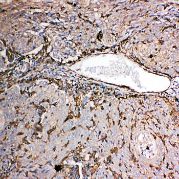 Gelsolin/GSN Rabbit Polyclonal Antibody