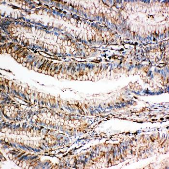 Gelsolin/GSN Rabbit Polyclonal Antibody