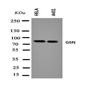 Gelsolin/GSN Rabbit Polyclonal Antibody