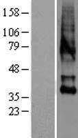 Oxytocin Receptor (OXTR) Human Over-expression Lysate