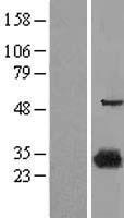 Prostaglandin dehydrogenase 1 (HPGD) Human Over-expression Lysate