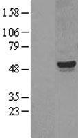CYP26A1 Human Over-expression Lysate