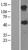 ABAT Human Over-expression Lysate