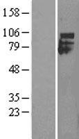 IFNAR1 Human Over-expression Lysate