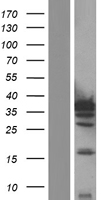 IL1 beta (IL1B) Human Over-expression Lysate