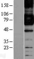 CD64 (FCGR1A) Human Over-expression Lysate