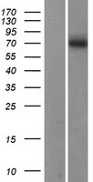 Acid sphingomyelinase (SMPD1) Human Over-expression Lysate