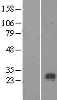 Collagen X (COL10A1) Human Over-expression Lysate