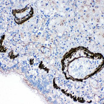 Gastrotropin FABP6 Rabbit Polyclonal Antibody