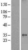 delta Sarcoglycan (SGCD) Human Over-expression Lysate