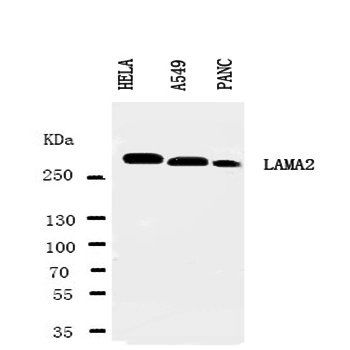Laminin 2 alpha/LAMA2 Rabbit Polyclonal Antibody