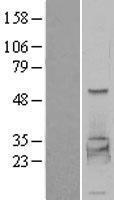 PHKG2 Human Over-expression Lysate